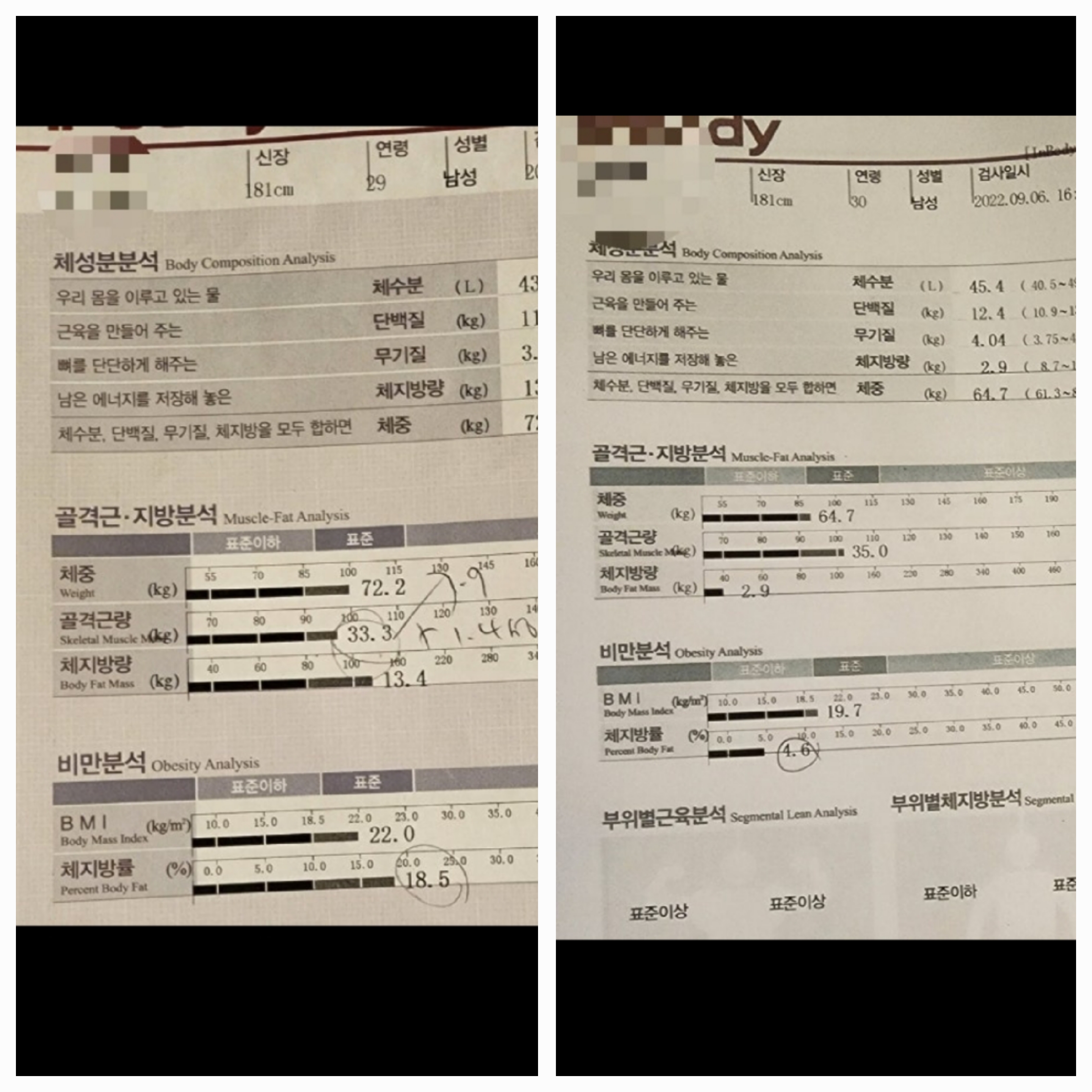 비포애프터9